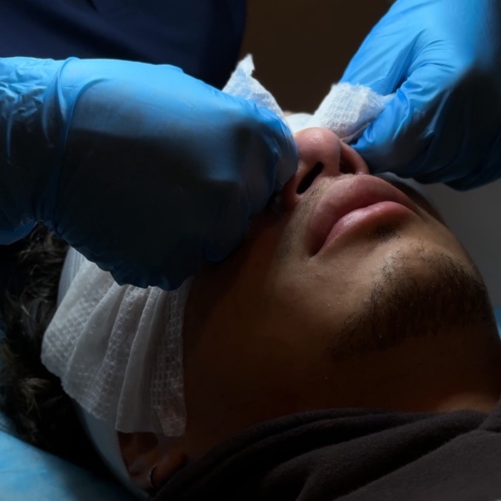 Face treatments at Sense Medical Spa in Port Chester, NY