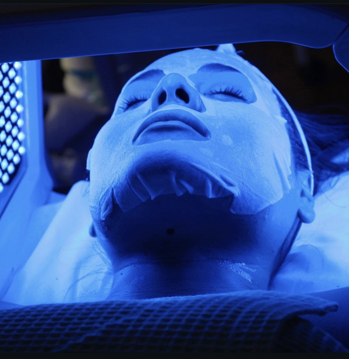 Non-surgical body contouring at Sense Medical Spa, Port Chester NY