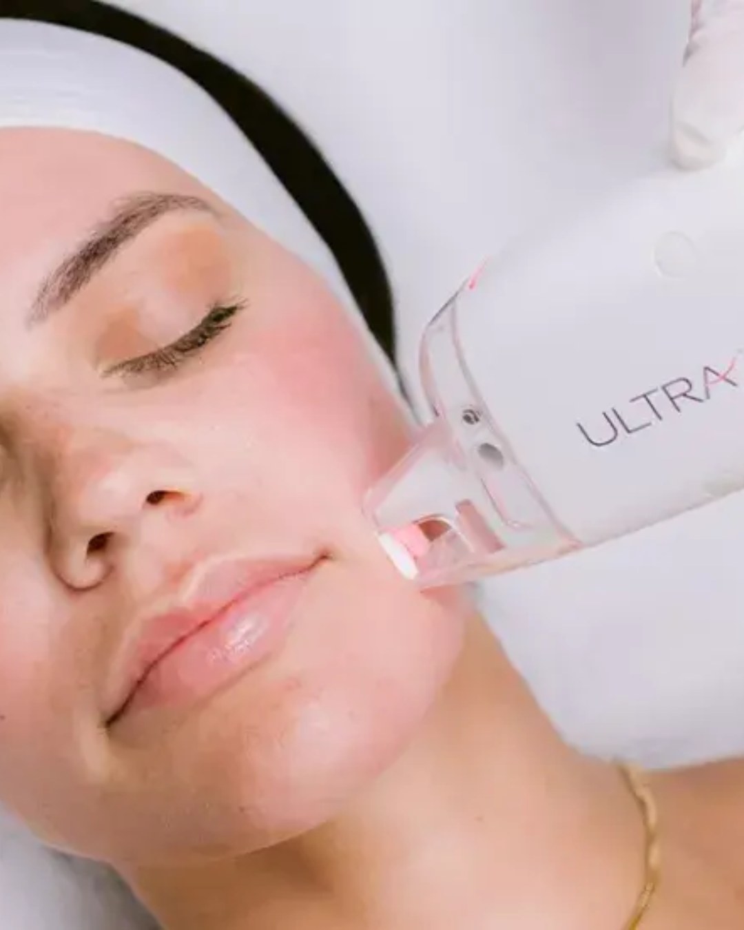 LaseMD Ultra at Sense Medical Spa in Port Chester, NY